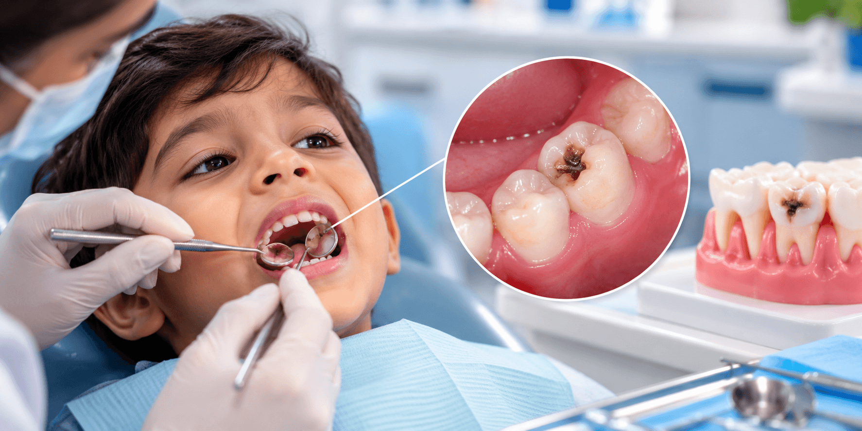 A dentist examining a child's milk tooth for signs of decay.